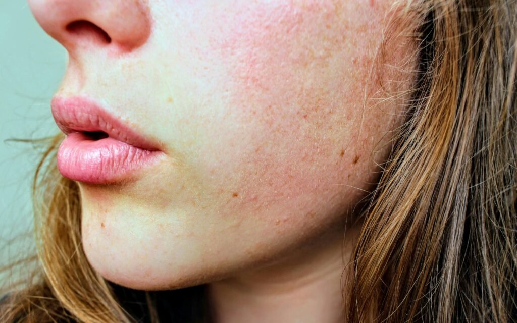 Lip Flip vs Lip Lift